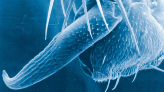 Magnified view of a fly's foot.