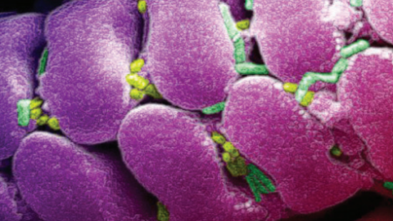 Magnified view of a fly's mouth.